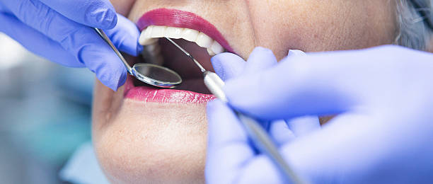 Best Emergency Wisdom Tooth Extraction in Union City, NJ